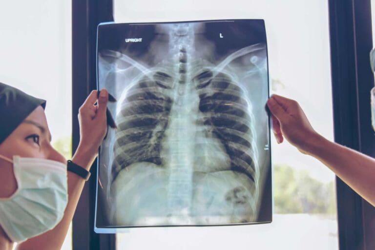 Talcum Powder May Pose a Risk to Lung Cancer Join the Many