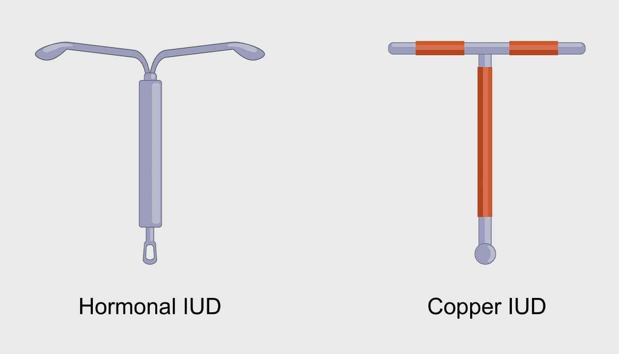 intrauterine device